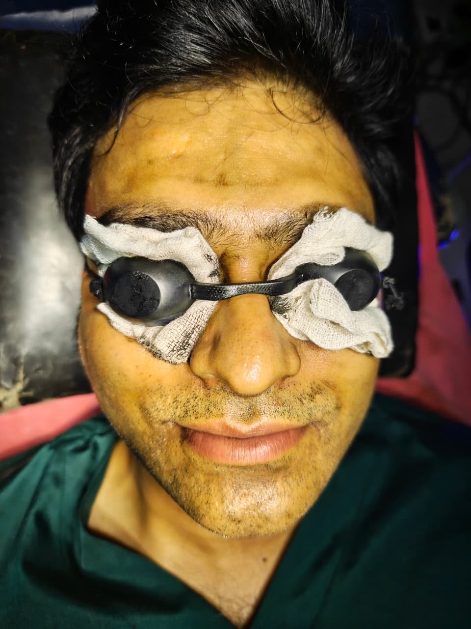 After Botox